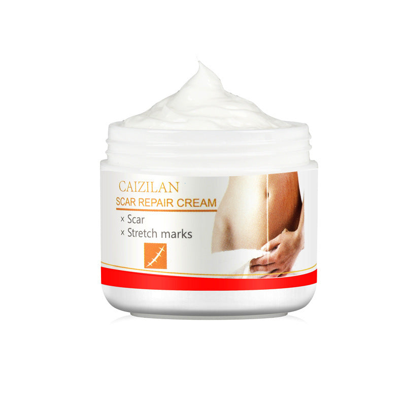 Pregnant Women Acne Cream