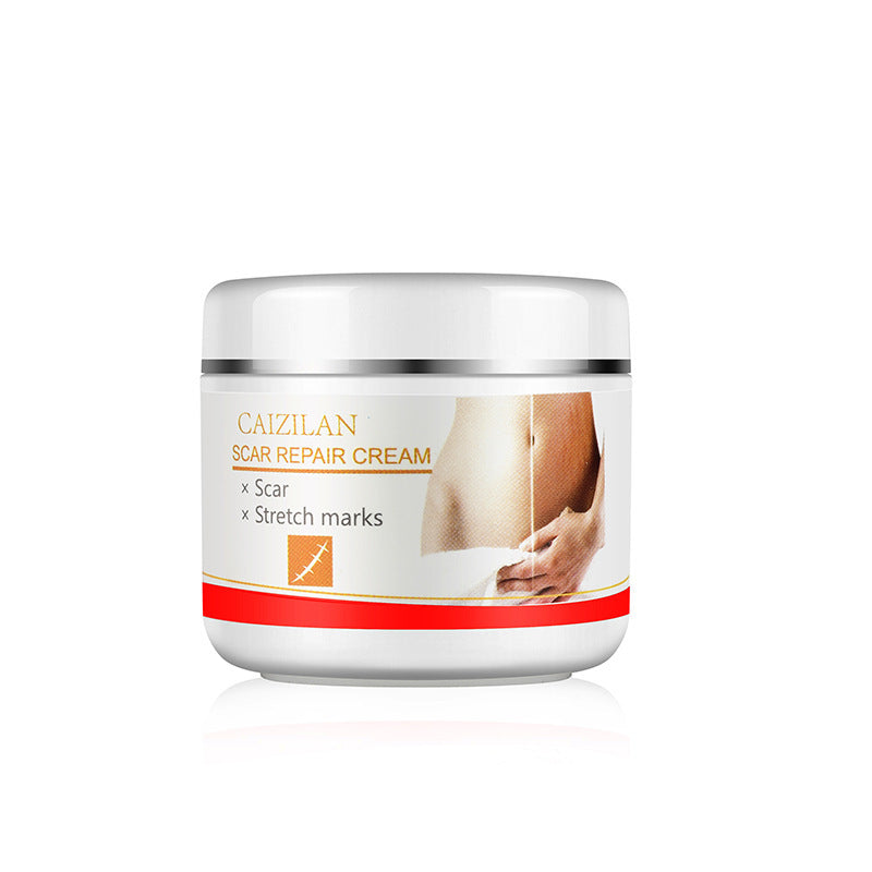 Pregnant Women Acne Cream