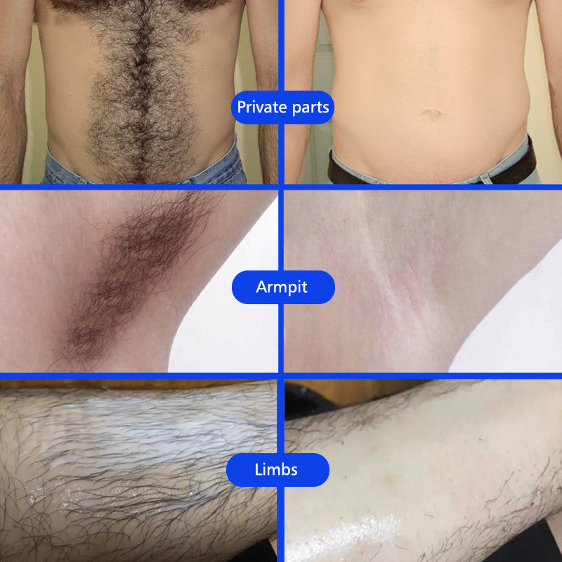 Underarm And Leg Skin Care Cream