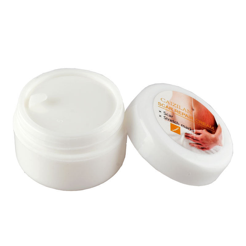 Pregnant Women Acne Cream