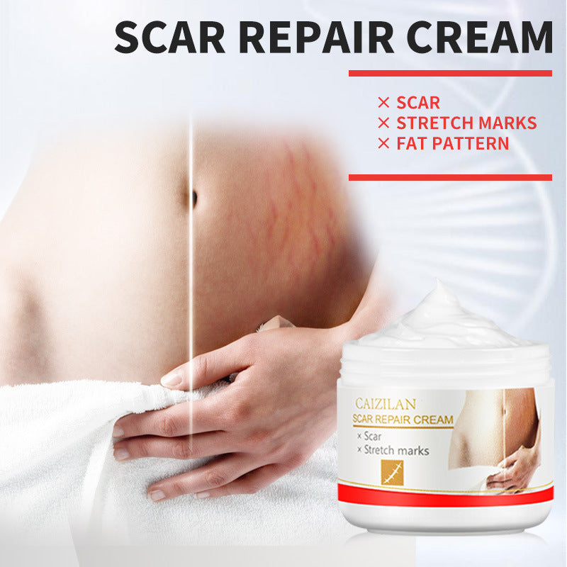 Pregnant Women Acne Cream