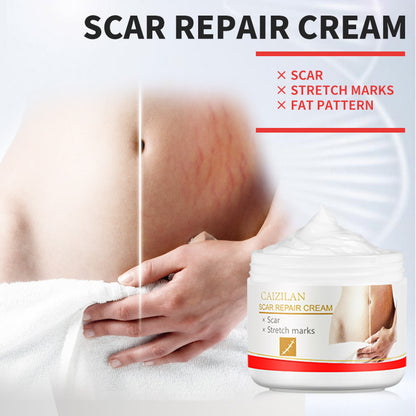 Pregnant Women Acne Cream